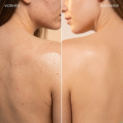 Tiefenreinigendes Peeling-Tuch